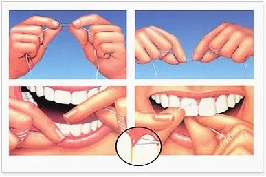 dental floss.webp