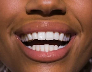 teeth.webp