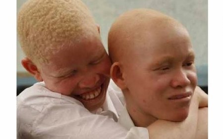 albinos.JPG