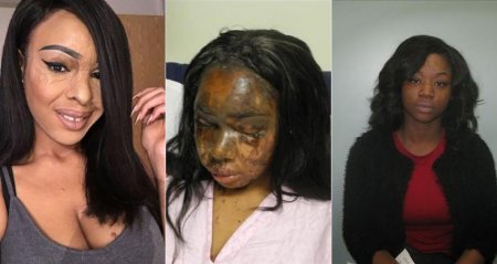 PROD-ACID-ATTACK-VICTIM-NAOMI-ONI-576x1024-tile.jpg