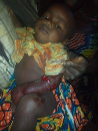 sad-photo-of-9-month-old-baby-allegedly-shot-in-mambilla-plateau-during-communal-clashes.jpg