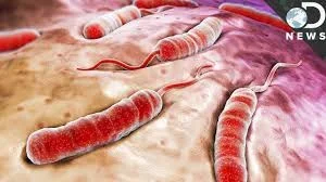cholera.webp