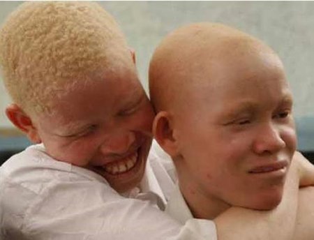 Albinos.jpg