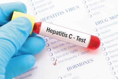 Hepatitic-C-test.-Photo-Harvard-Health-897x598.jpg