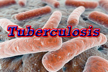 Tuberculosis.png
