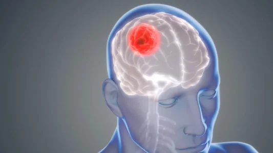 Brain-CancerGlioblastoma-1062x598.webp