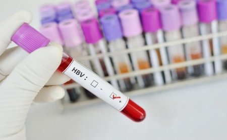 hepatitis-b.jpg