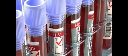 HIV-AIDS-Test.jpg