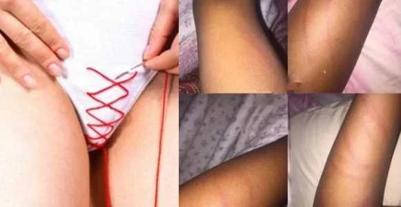 The girl was beaten mercilessly..webp
