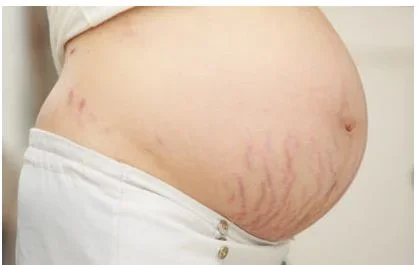 pregnancy.webp