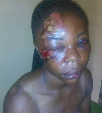 woman beaten.JPG
