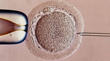 experimental form of IVF.jpg