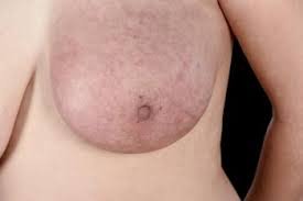 breast cancer.jpg