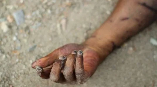 Dead-hand.webp