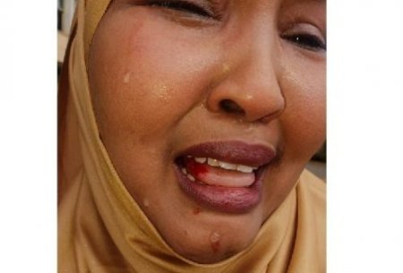 Female-MP-beaten-up-in-Kenya-by-colleague.jpeg