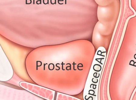 prostate.JPG