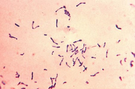 Corynebacterium_diphtheriae_Gram_stain.jpg