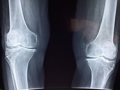 knee-2253047_640.jpg