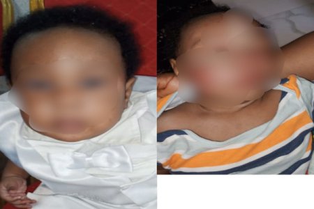 Nigerian Father Calls for Investigation After Baby's Mysterious Attack at Daycare