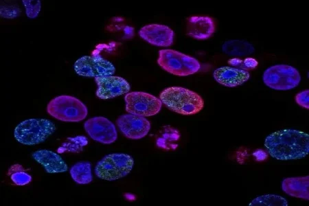 sickle cell (1).webp sickle cell (1).webp