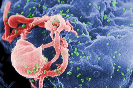HIV-budding-Color.webp HIV-budding-Color.webp