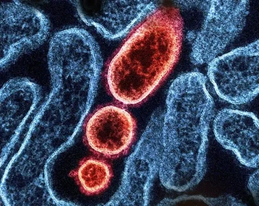 Nipah Virus Outbreak in India Triggers Heightened Airport Screening Across Asia