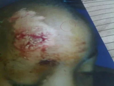 Samuels-head-smashed-by-robbers-448x336.webp