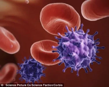 hiv aidss.webp