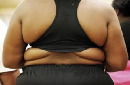 obesity 2.webp