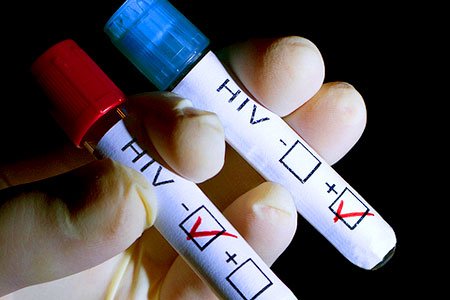 hiv test.jpg