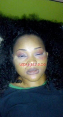 Nollywood Actress Mercy Aigbe Battered By Her Husband [PHOTOS]