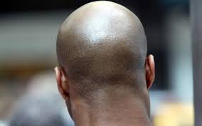 bald men.jpg